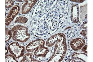 Immunohistochemistry (IHC) image for anti-Acetyl-CoA Acyltransferase 2 (ACAA2) antibody (ABIN1495726)