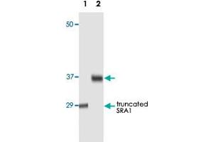 Western blot analysis using SRA1 monoclonal antibody, clone 7H1G1  against truncated SRA1 recombinant protein (1) and human ovarian cancer tissue lysate (2). (SRA1 anticorps)