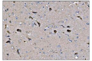 IHC analysis of Dynamin 3/DNM3 using anti-Dynamin 3/DNM3 antibody (ABIN7601163). (Dynamin 3 anticorps  (AA 295-712))