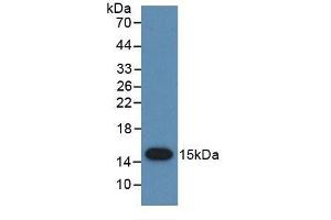 Detection of Recombinant PSCA, Human using Monoclonal Antibody to Prostate Stem Cell Antigen (PSCA) (PSCA anticorps  (AA 22-95))