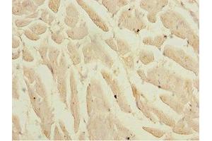 Immunohistochemistry of paraffin-embedded human heart tissue using ABIN7157736 at dilution of 1:100