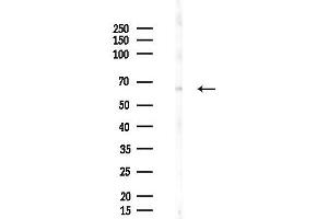 anti-Optineurin (OPTN) (pSer177) antibody