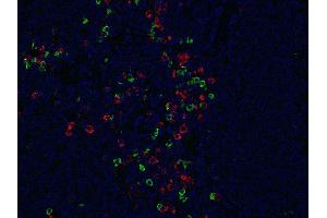 Indirect immunostaining of formalin-fixed paraffin embedded human tonsil section with anti-λ light chain (dilution 1 : 200; green) and mouse anti-κ light chain (cat. (Lapin anti-Humain IgG lambda (Light Chain) Anticorps)