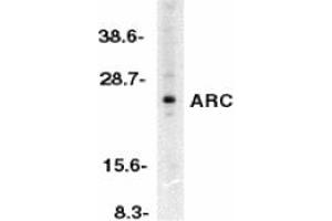 Image no. 1 for anti-Nucleolar Protein 3 (Apoptosis Repressor with CARD Domain) (NOL3) antibody (ABIN203569) (NOL3 anticorps)