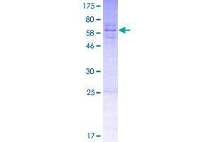 Image no. 1 for Speedy Homolog A (SPDYA) (AA 1-313) protein (GST tag) (ABIN1321134)