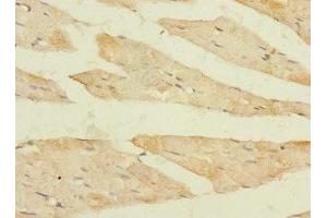 Immunohistochemistry of paraffin-embedded human skeletal muscle tissue using ABIN7152439 at dilution of 1:100 (FBXO4 anticorps  (AA 201-500))