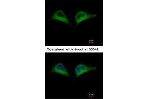 ICC/IF Image Immunofluorescence analysis of methanol-fixed HeLa, using PSMD7, antibody at 1:500 dilution. (PSMD7 anticorps)