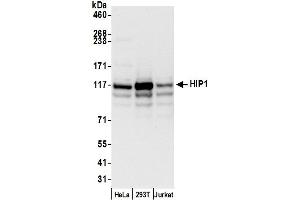 anti-Huntingtin Interacting Protein 1 (HIP1) (AA 725-775) antibody