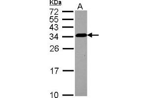 Western Blotting (WB) image for anti-Tubulin Folding Cofactor B (TBCB) (AA 1-219) antibody (ABIN1501321) (TBCB anticorps  (AA 1-219))