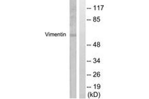 Western blot analysis of extracts from A549 cells, treated with Nocodazole 1ug/ml 16h, using Vimentin (Ab-56) Antibody. (Vimentin anticorps  (AA 31-80))
