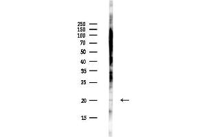 Western blot analysis of lysates from Hela cells(UV,30 min treatment), using C12orf65 Antibody at 1/1000 dilution.