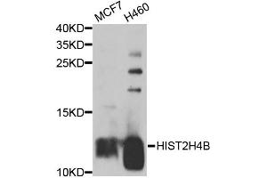 Western blot analysis of extracts of various cell lines, using HIST2H4B antibody (ABIN5974305) at 1/1000 dilution. (Histone Cluster 2, H4b (HIST2H4B) anticorps)