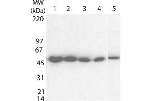 Western blot using  Anti-Tetanus Toxin C antibody shows detection of a band at ~52 kDa corresponding to full length 6X His-TTFC fusion protein (arrowhead). (Tetanus Toxin C-Fragment (TTC) anticorps)