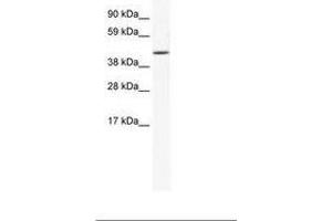 Image no. 1 for anti-Runt-Related Transcription Factor 3 (RUNX3) (AA 323-372) antibody (ABIN202455) (RUNX3 anticorps  (AA 323-372))