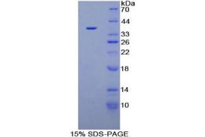 SDS-PAGE (SDS) image for Plasminogen (PLG) protein (His tag) (ABIN1099382) (PLG Protein (His tag))