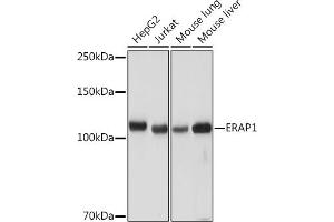 Western blot analysis of extracts of various cell lines, using ER Rabbit mAb (ABIN7266941) at 1:1000 dilution. (ERAP1 anticorps)