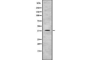 Western blot analysis of RAE1 using COLO205 whole cell lysates (RAE1 anticorps  (C-Term))