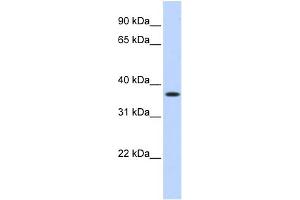 WB Suggested Anti-MTHFD2 Antibody Titration:  0. (MTHFD2 anticorps  (Middle Region))