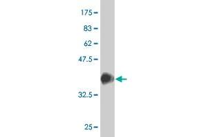 Western Blot detection against Immunogen (37. (SRF anticorps  (AA 406-508))