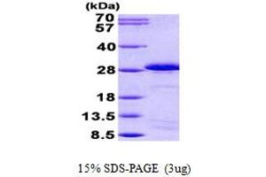 SDS-PAGE (SDS) image for Sperm Autoantigenic Protein 17 (SPA17) (AA 1-151) protein (His tag) (ABIN5852921) (SPA17 Protein (AA 1-151) (His tag))