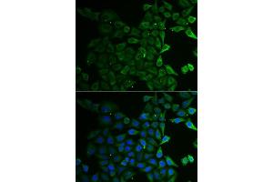 Immunofluorescence analysis of U2OS cells using C21orf33 antibody. (C21orf33 anticorps  (AA 42-268))