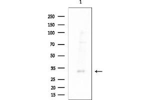 anti-Purinergic Receptor P2Y, G-Protein Coupled, 14 (P2RY14) (Internal Region) antibody