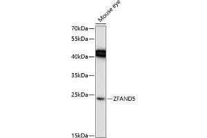 Western blot analysis of extracts of mouse eye, using ZF Antibody (ABIN6130935, ABIN6150428, ABIN6150429 and ABIN6217088) at 1:1000 dilution. (ZFAND5 anticorps  (AA 40-150))