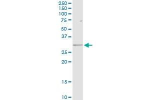 HLA-DRB5 MaxPab rabbit polyclonal antibody.