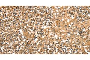 Immunohistochemistry of paraffin-embedded Human tonsil tissue using SLC8A3 Polyclonal Antibody at dilution 1:35 (SLC8A3 anticorps)