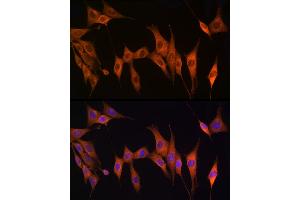 Immunofluorescence analysis of NIH/3T3 cells using Thymidine Kinase 1 Rabbit pAb (ABIN6132726, ABIN6149198, ABIN6149199 and ABIN6221245) at dilution of 1:150 (40x lens).