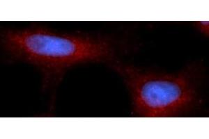 Immunofluorescence (IF) image for anti-Poly Binding Protein Interacting Protein 2 (PAIP2) (AA 1-127) antibody (PE) (ABIN5568398)