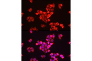 Immunohistochemistry of paraffin-embedded mouse kidney using GALC antibody (ABIN1679950, ABIN3018222, ABIN3018224 and ABIN6220405) at dilution of 1:100 (40x lens).