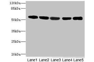 Western blot All lanes: FRKantibody at 3. (FRK anticorps  (AA 1-220))