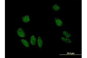 Immunofluorescence of purified MaxPab antibody to MYL5 on HeLa cell. (MYL5 anticorps  (AA 1-173))