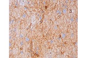IHC testing of human brain stained with GFAP antibody (GA-5). (GFAP anticorps)