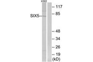 Western blot analysis of extracts from K562 cells, using SIX5 Antibody.