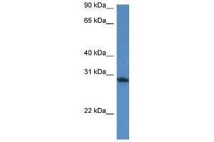 Western Blot showing Fam168a antibody used at a concentration of 1. (FAM168A anticorps  (N-Term))