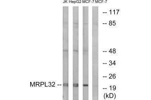 Western blot analysis of extracts from Jurkat cells, MCF-7 cells and HepG2 cells, using MRPL32 antibody. (MRPL32 anticorps)