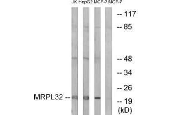 MRPL32 anticorps