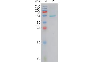 Human CRCP Protein, hFc Tag on SDS-PAGE under reducing condition.