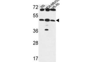 Western Blotting (WB) image for anti-UDP-GlcNAc:betaGal beta-1,3-N-Acetylglucosaminyltransferase 5 (B3GNT5) antibody (ABIN3004261)