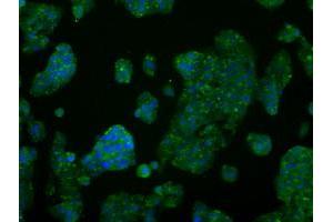 Image no. 6 for anti-V-Akt Murine Thymoma Viral Oncogene Homolog 2 (AKT2) antibody (ABIN1496564)