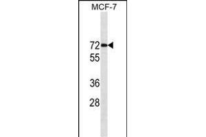 ESR1/ER Antibody (ABIN1539856 and ABIN2843829) western blot analysis in MCF-7 cell line lysates (35 μg/lane). (Estrogen Receptor alpha anticorps  (AA 246-273))