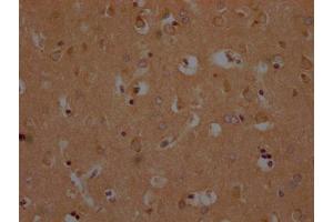 IHC image of ABIN7139952 diluted at 1:200 and staining in paraffin-embedded human brain tissue performed on a Leica BondTM system.