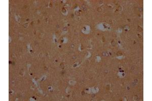 IHC image of ABIN7139952 diluted at 1:200 and staining in paraffin-embedded human brain tissue performed on a Leica BondTM system. (OR1A2 anticorps  (AA 247-262))