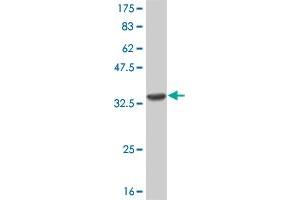 Western Blot detection against Immunogen (32. (CNR2 anticorps  (AA 302-360))