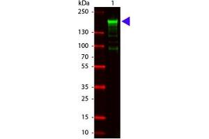 Image no. 1 for anti-alpha-2-Macroglobulin (A2M) antibody (ABIN799706) (alpha 2 Macroglobulin anticorps)