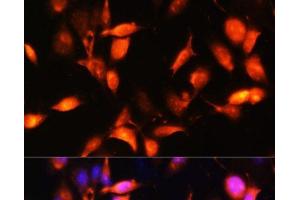 Immunofluorescence analysis of NIH-3T3 cells using ARL4A Polyclonal Antibody at dilution of 1:100.