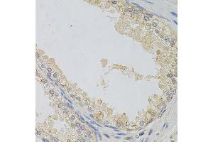 Immunohistochemistry of paraffin-embedded human prostate using NAPA antibody. (NAPA anticorps)