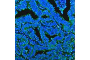 IF analysis of CD13/Anpep using anti-CD13/Anpep antibody (ABIN7602222).